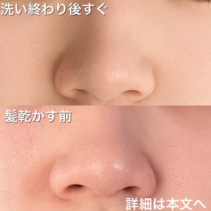 ディズム オールインワンジェル/DISM/オールインワン化粧品を使ったクチコミ(5枚目)