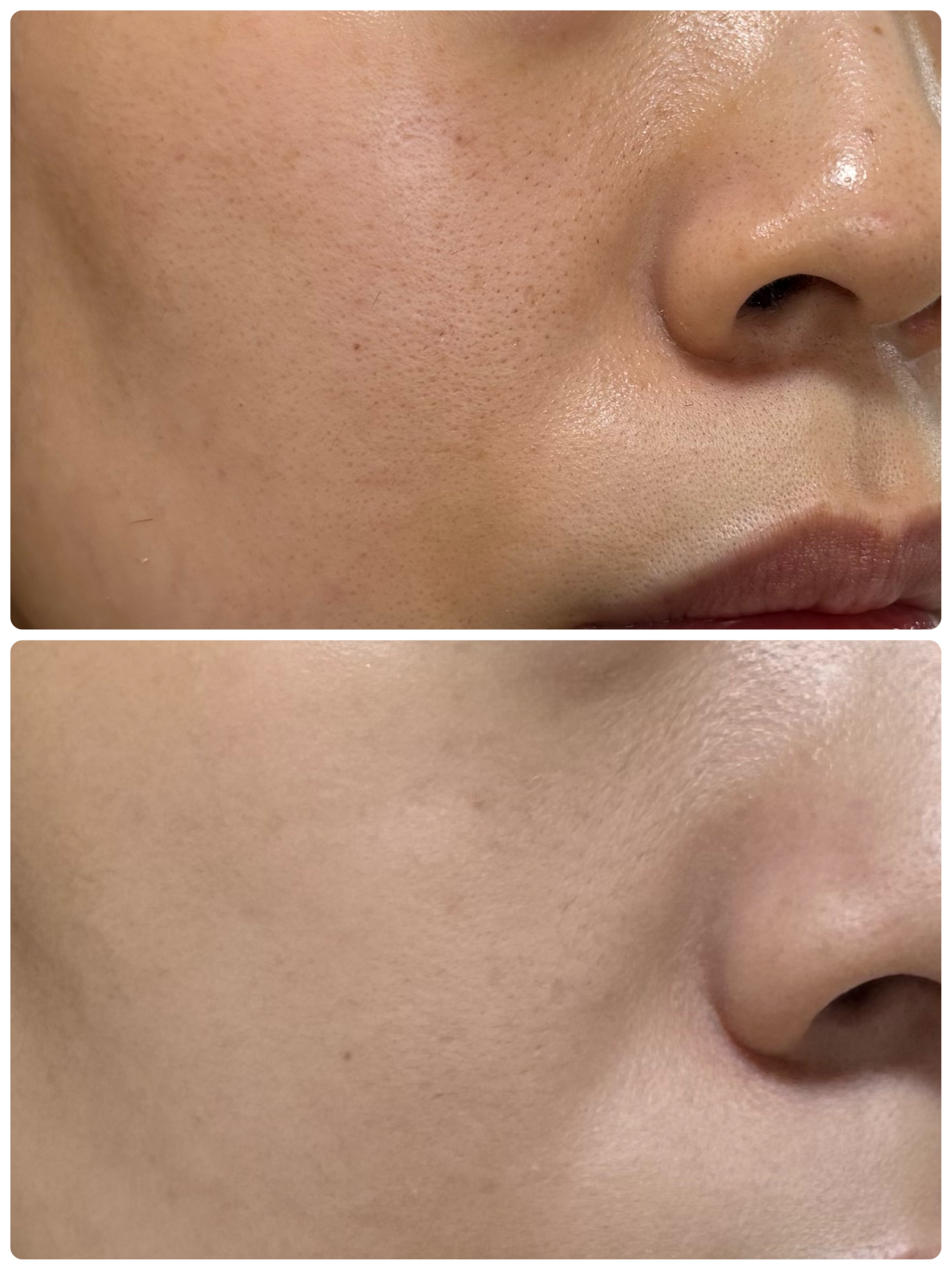 パウダリーファンデーション レジェンダリー グロウ/ブリリアージュ/パウダーファンデーションを使ったクチコミ（3枚目）