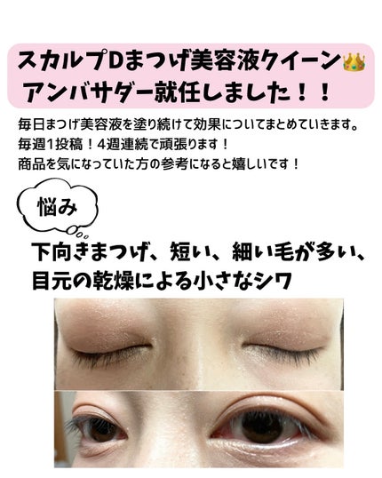 スカルプDまつ毛美容液 クイーン/アンファー(スカルプD)/まつげ美容液を使ったクチコミ(3枚目)