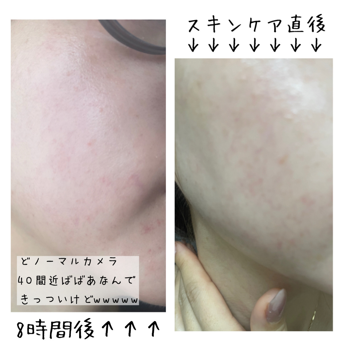 ドクダミ77 % 鎮静マスクパック/Anua/シートマスク・パックを使ったクチコミ（2枚目）