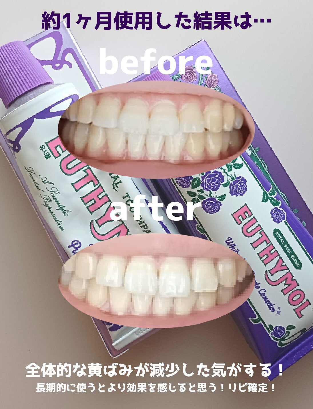 ホワイトニングパープルコレクター歯磨き粉/EUTHYMOL/その他を使ったクチコミ（3枚目）