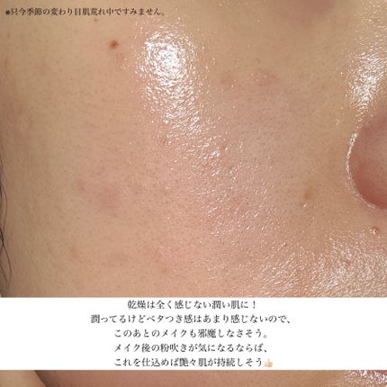 チャーガチャージドロップ/SERUMKIND/美容液を使ったクチコミ(4枚目)