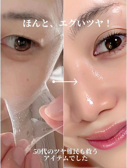 TXナイアシンエッセンストナー/SKIN&LAB/化粧水を使ったクチコミ(9枚目)