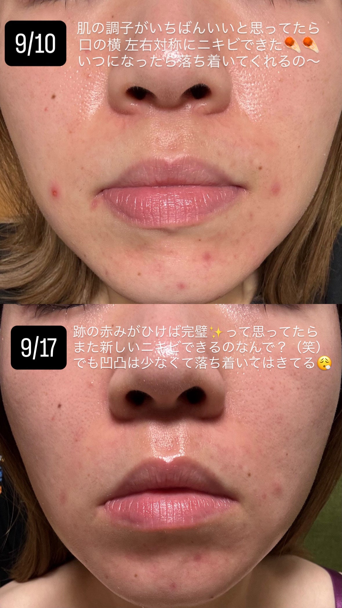 な ☺︎ *:.フォロバ100.:* on LIPS 「昨日投稿した動画をゆっくりみれるように同じものを写真でも投稿し..」(3枚目)