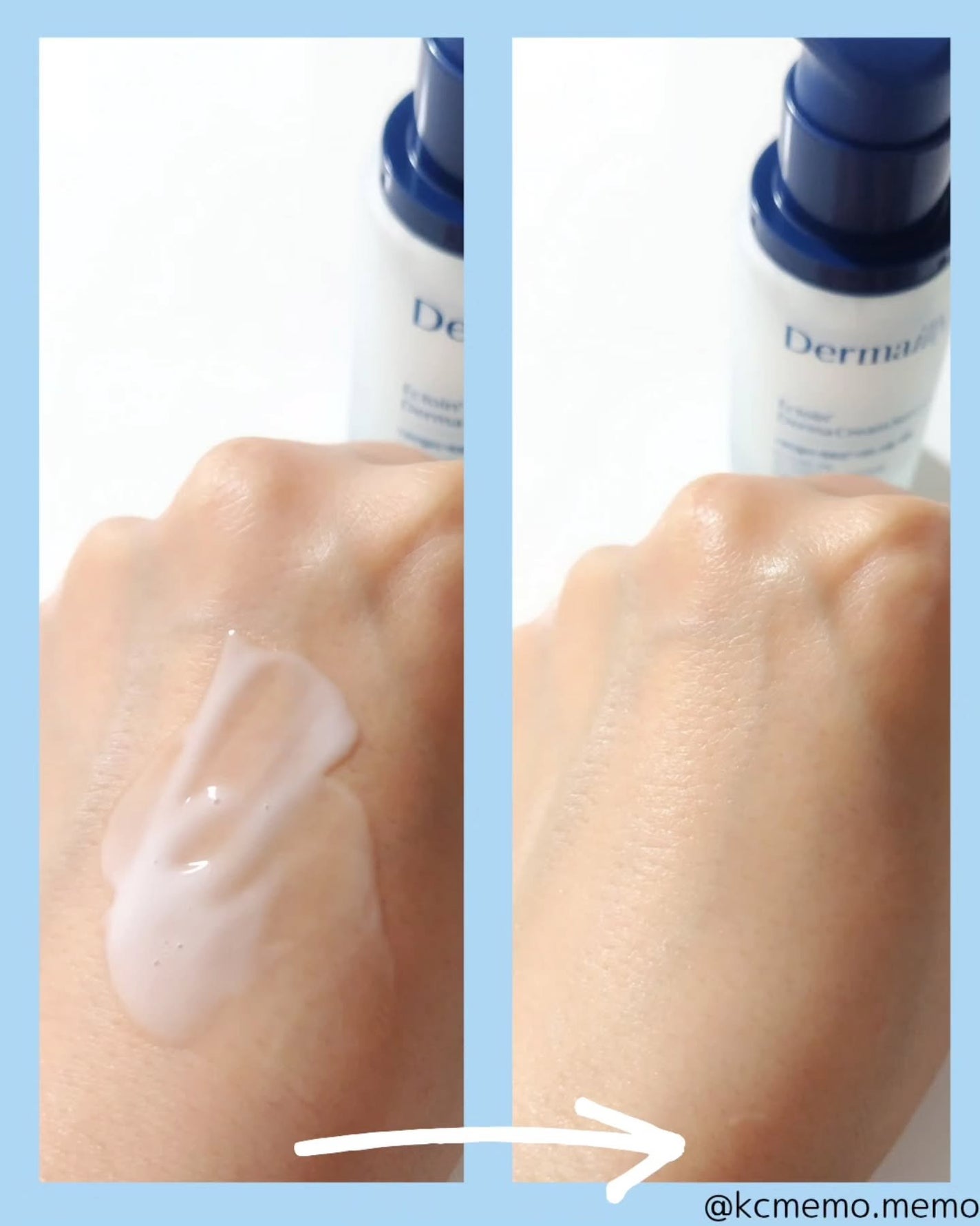 メモ魔ちゃん@韓国コスメメモ日記 on LIPS 「乾燥肌民にオススメ!本日のメモ✍️♡Dermailly ダーマ..」(6枚目)