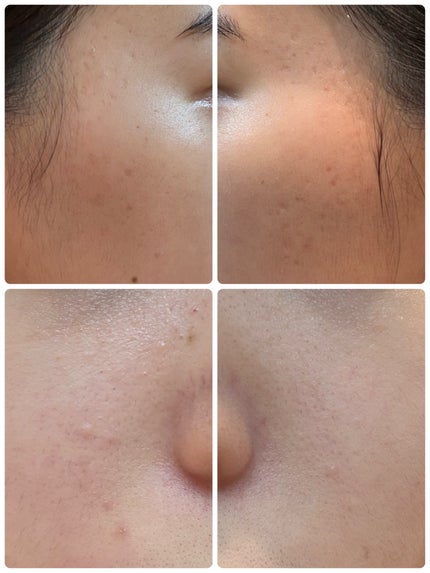 エターナルアイクリーム 8g/リュバンブラン/アイケア・アイクリームを使ったクチコミ(2枚目)