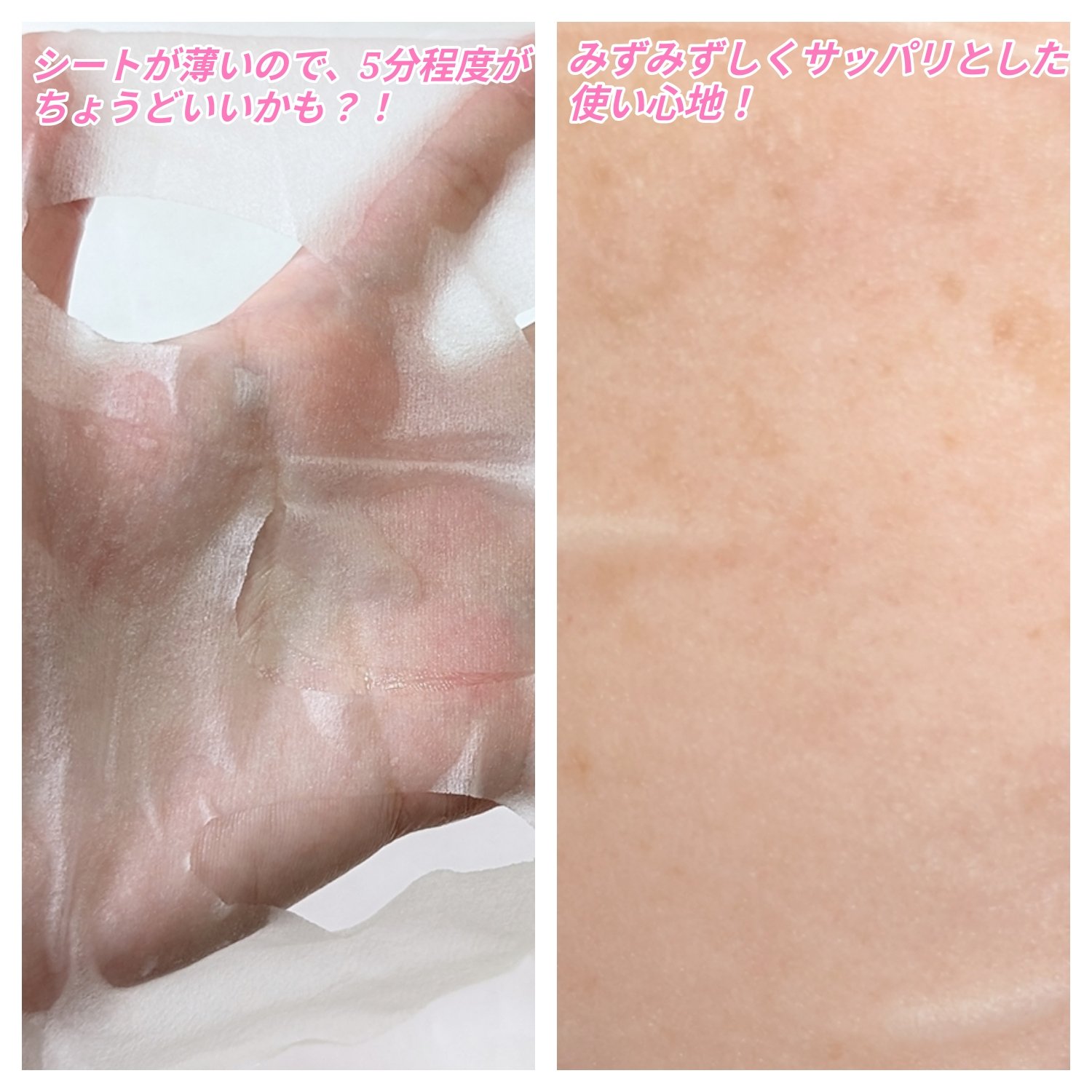 ビタギビング デイリーアクアセラムマスク/ByUR/シートマスク・パックを使ったクチコミ（2枚目）