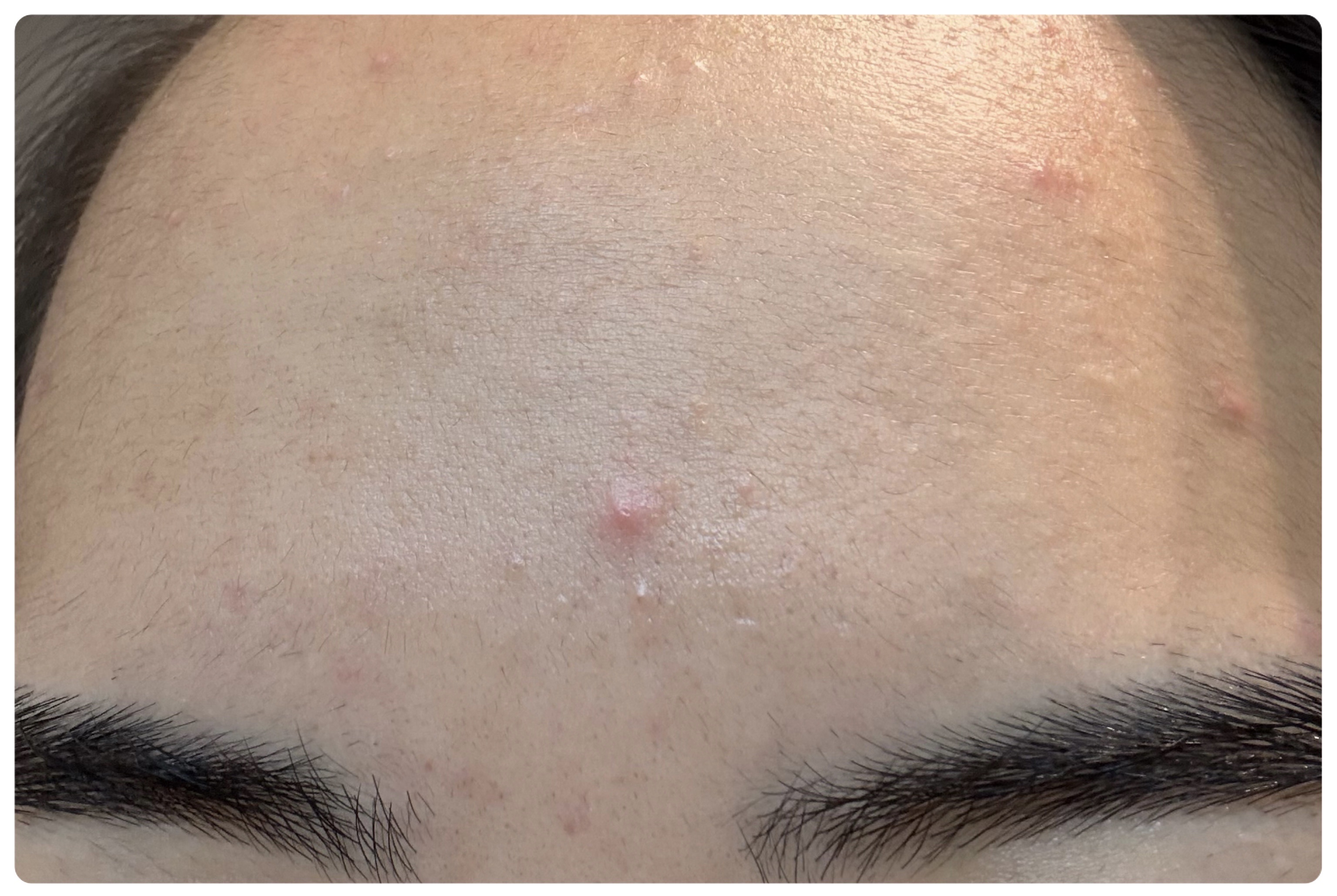 薬用雪肌精 ブライトニング クレンジング オイル[医薬部外品]/雪肌精/オイルクレンジングを使ったクチコミ（3枚目）