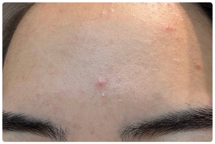 エターナルアイクリーム 8g/リュバンブラン/アイケア・アイクリームを使ったクチコミ(3枚目)