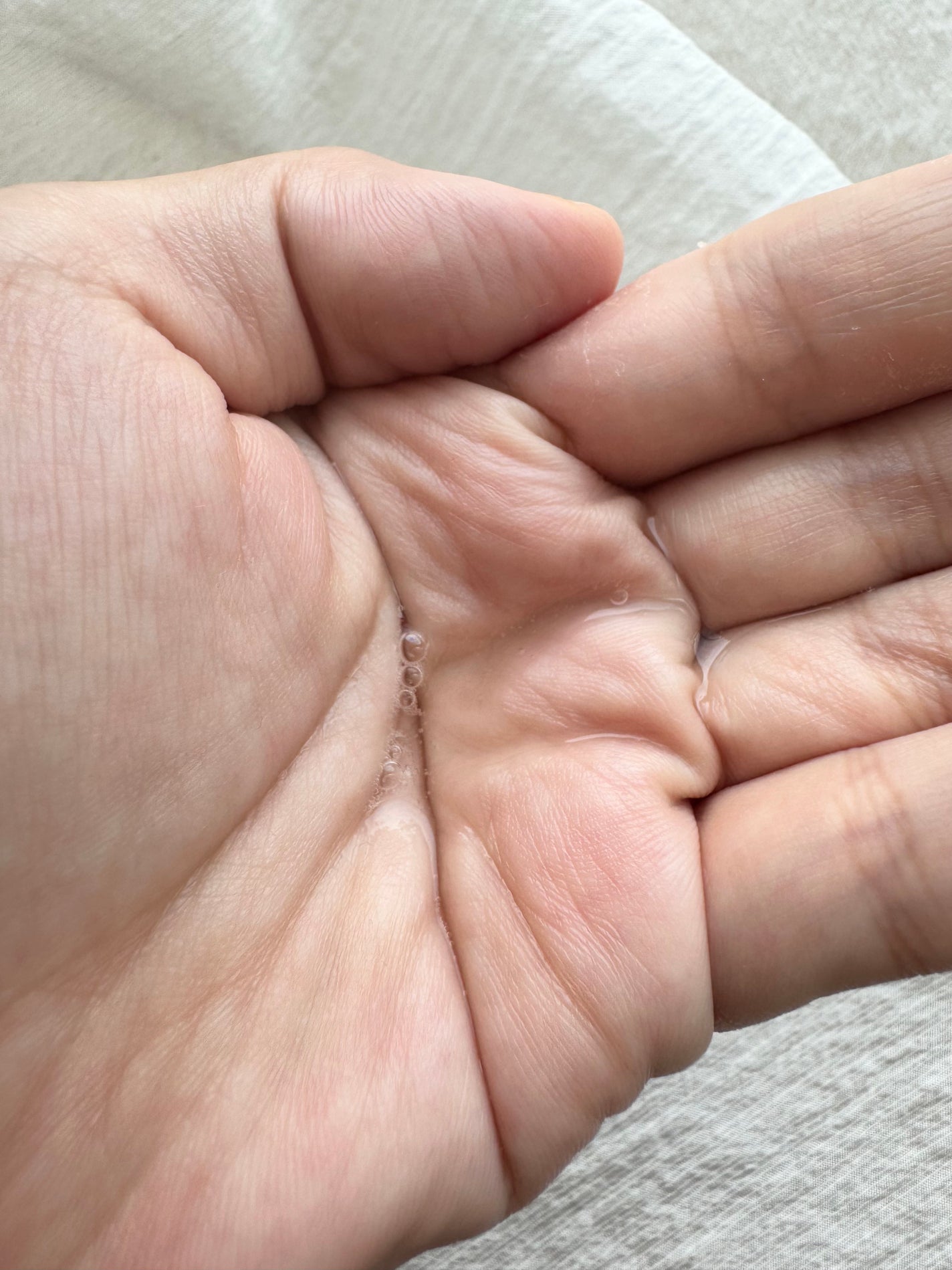 MT プロミネント・エッセンス/MTメタトロン/美容液を使ったクチコミ(2枚目)