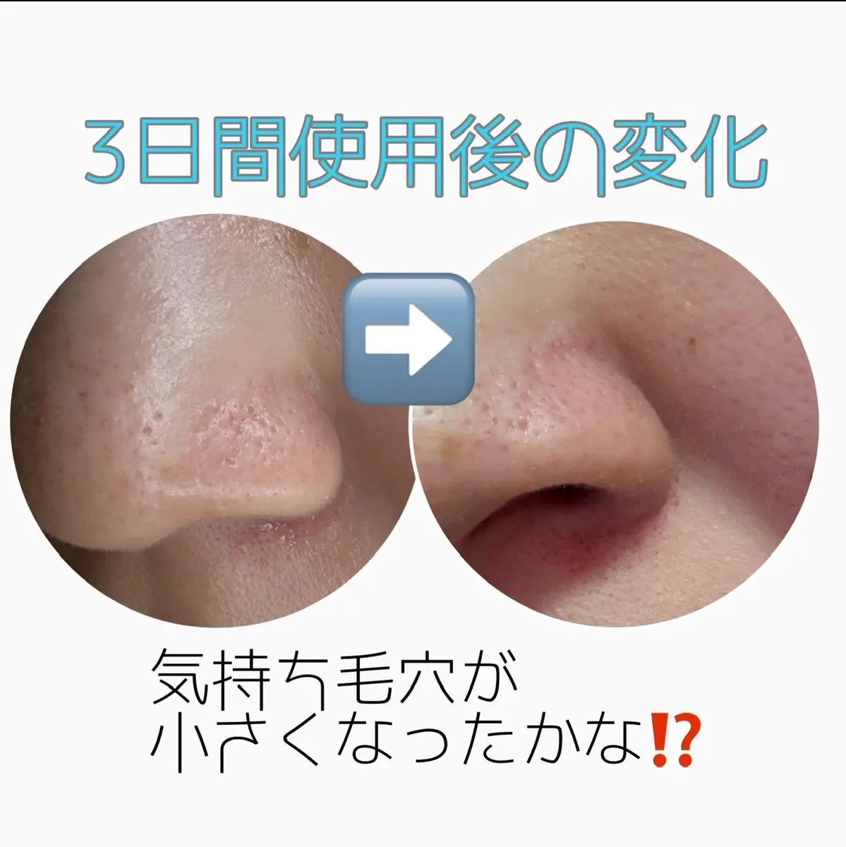 セラミドアクア クレンジングオイル/VT/オイルクレンジングを使ったクチコミ(2枚目)