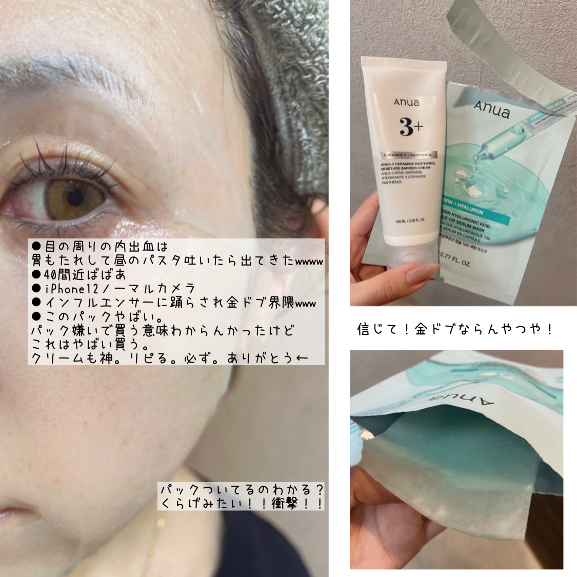 ドクダミ77 % 鎮静マスクパック/Anua/シートマスク・パックを使ったクチコミ（1枚目）