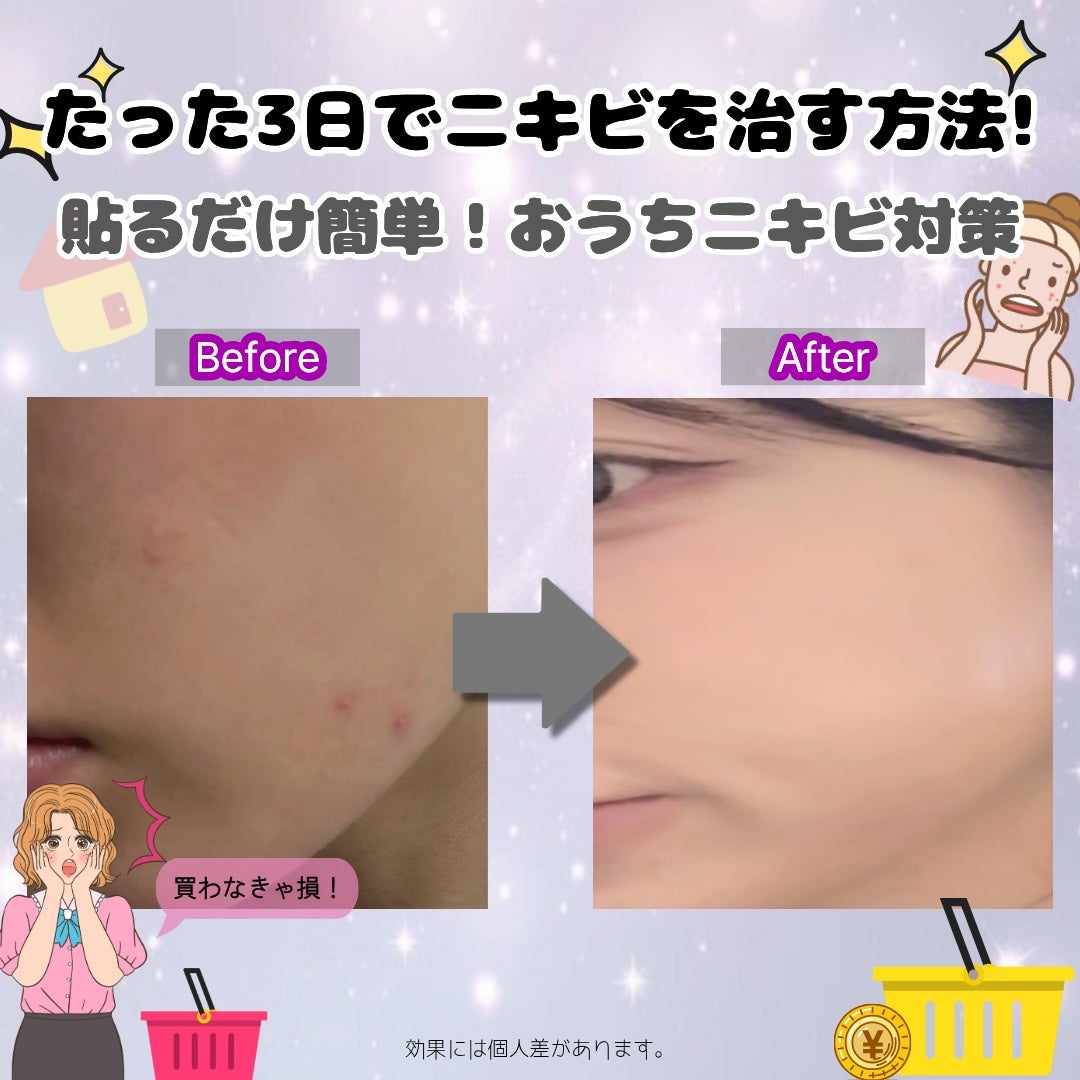 ガヨニ on LIPS 「やっほー!Qoo10で見つけたこのアイテム、肌がめっちゃよくな..」(1枚目)
