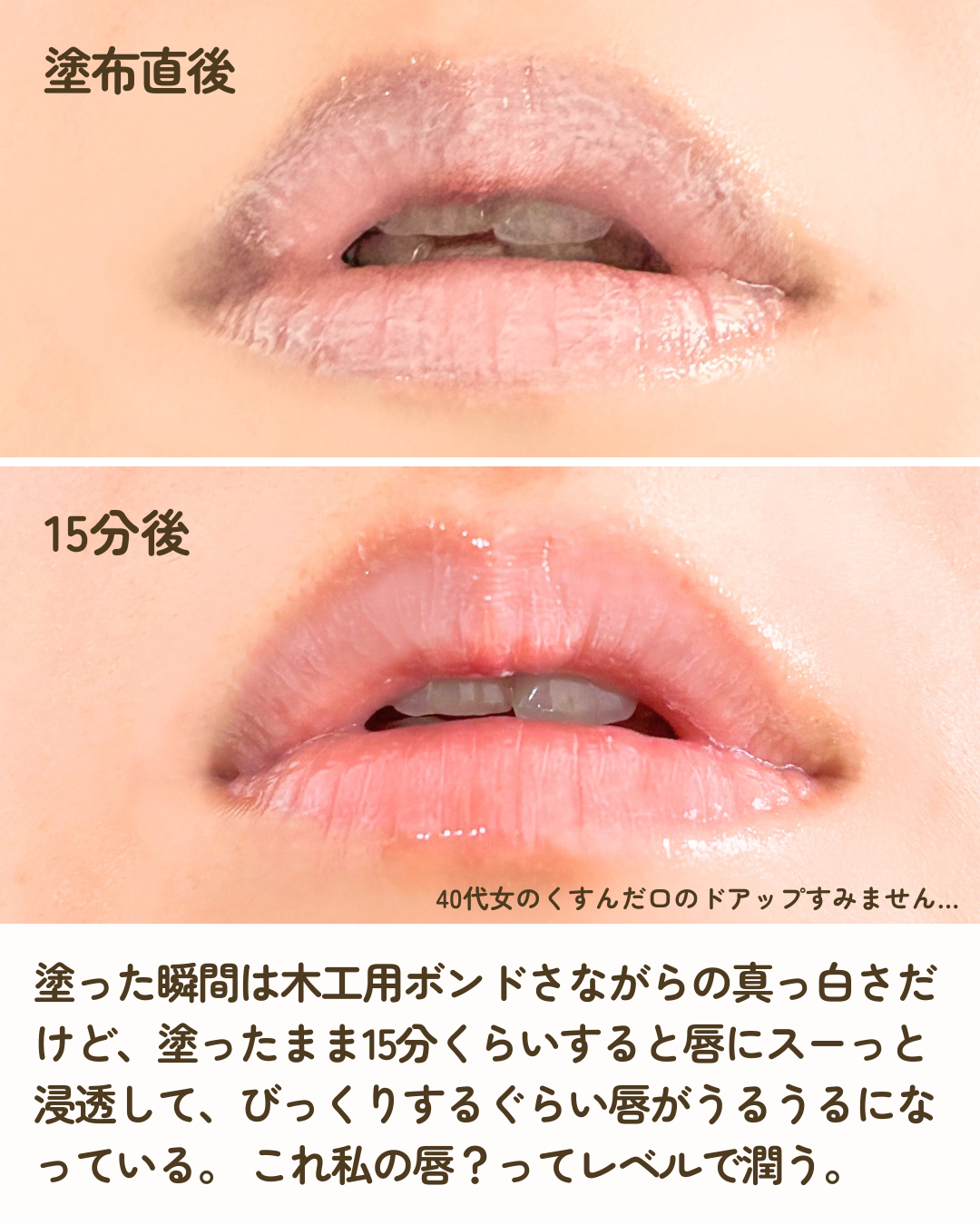 メディプラス リペアリップパック 15g/メディプラス/リップケアを使ったクチコミ（3枚目）