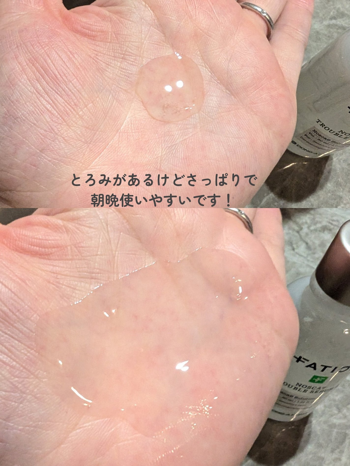 ノスカナイントラブルセラムS/FATION/美容液を使ったクチコミ(4枚目)