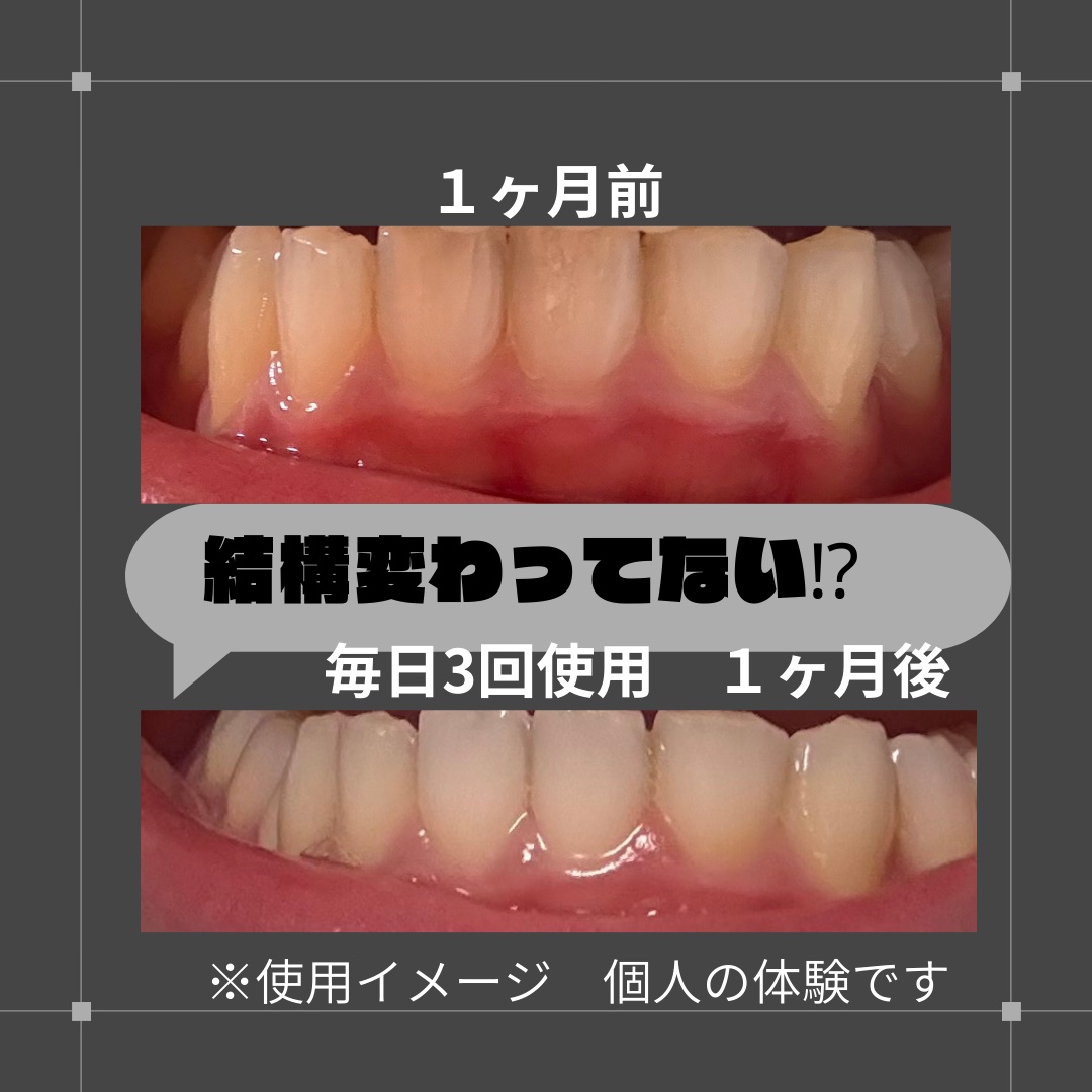 美白スミガキ/小林製薬/歯磨き粉を使ったクチコミ（2枚目）