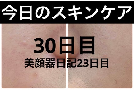 エターナルアイクリーム 8g/リュバンブラン/アイケア・アイクリームを使ったクチコミ(1枚目)