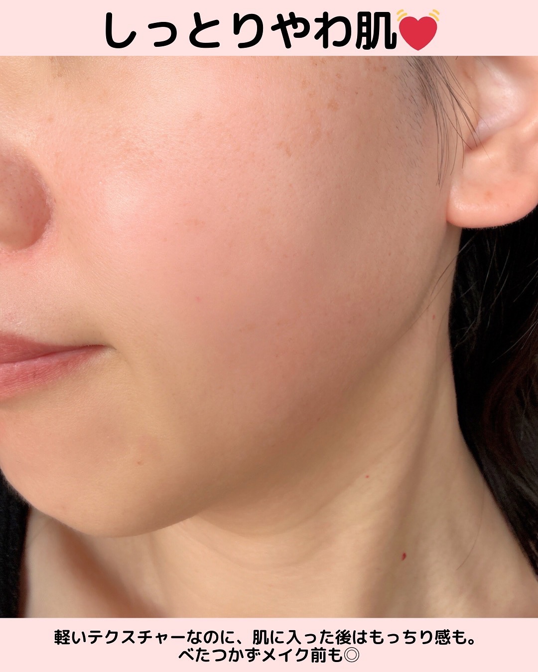 サンシビオ ダーマローション D/ビオデルマ/化粧水を使ったクチコミ（3枚目）