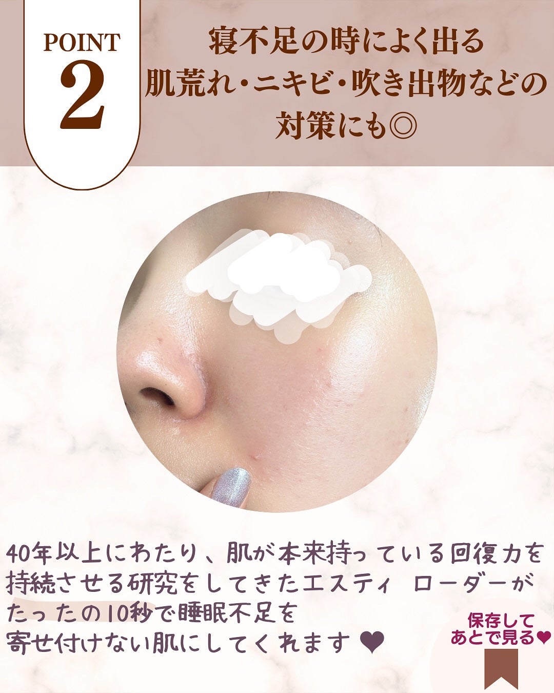 アドバンス ナイト リペア SMR コンプレックス/ESTEE LAUDER/美容液を使ったクチコミ(5枚目)