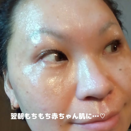 PDRN+リードルS 100/VT/美容液を使ったクチコミ(7枚目)