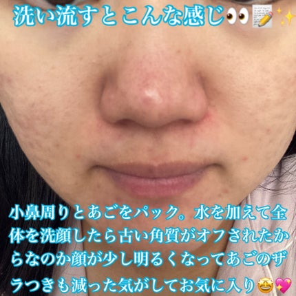 ニベア2WAY美容洗顔 AC/ニベア/洗顔フォームを使ったクチコミ(5枚目)