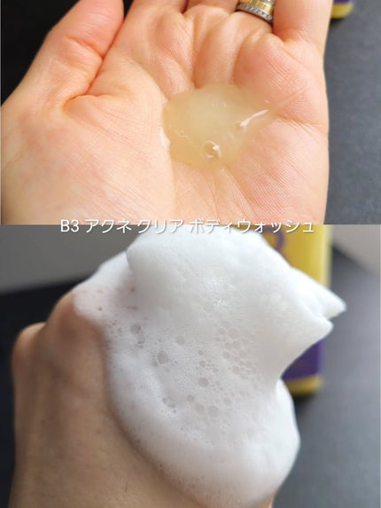 ナイアシンアミド 5% ボディローション/b.clinicx/ボディローションを使ったクチコミ(4枚目)