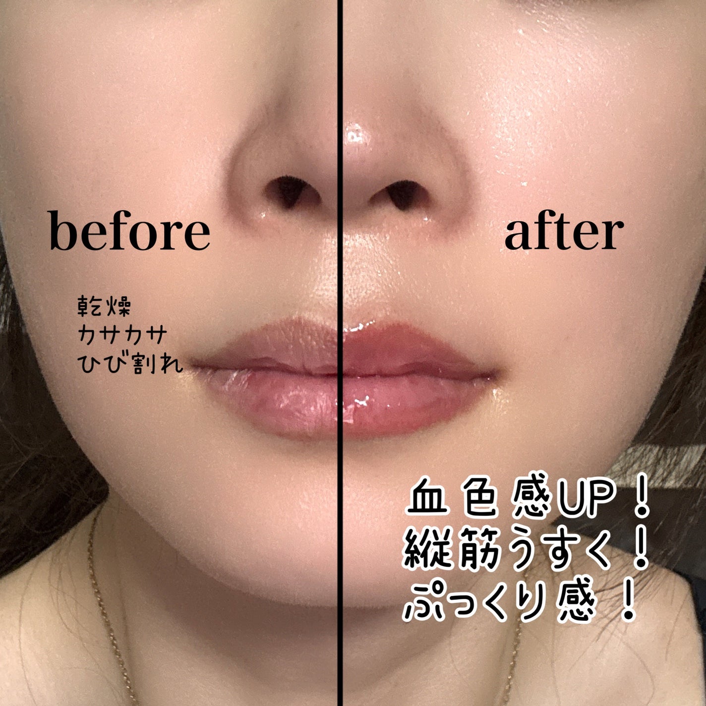 ボリュームリッププランパー/BANILA CO/リッププランパーを使ったクチコミ(3枚目)