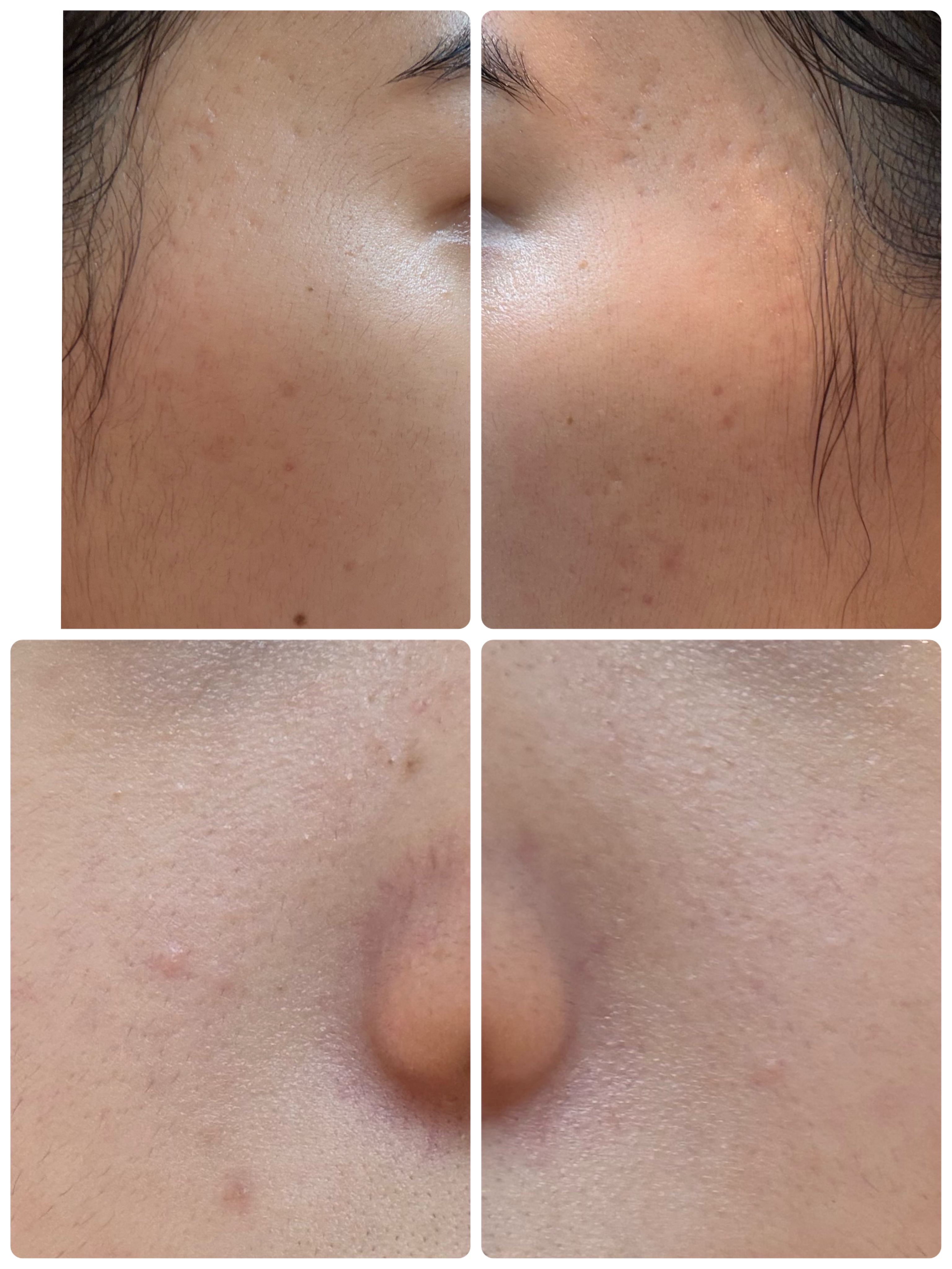 薬用雪肌精 ブライトニング クレンジング オイル[医薬部外品]/雪肌精/オイルクレンジングを使ったクチコミ（2枚目）