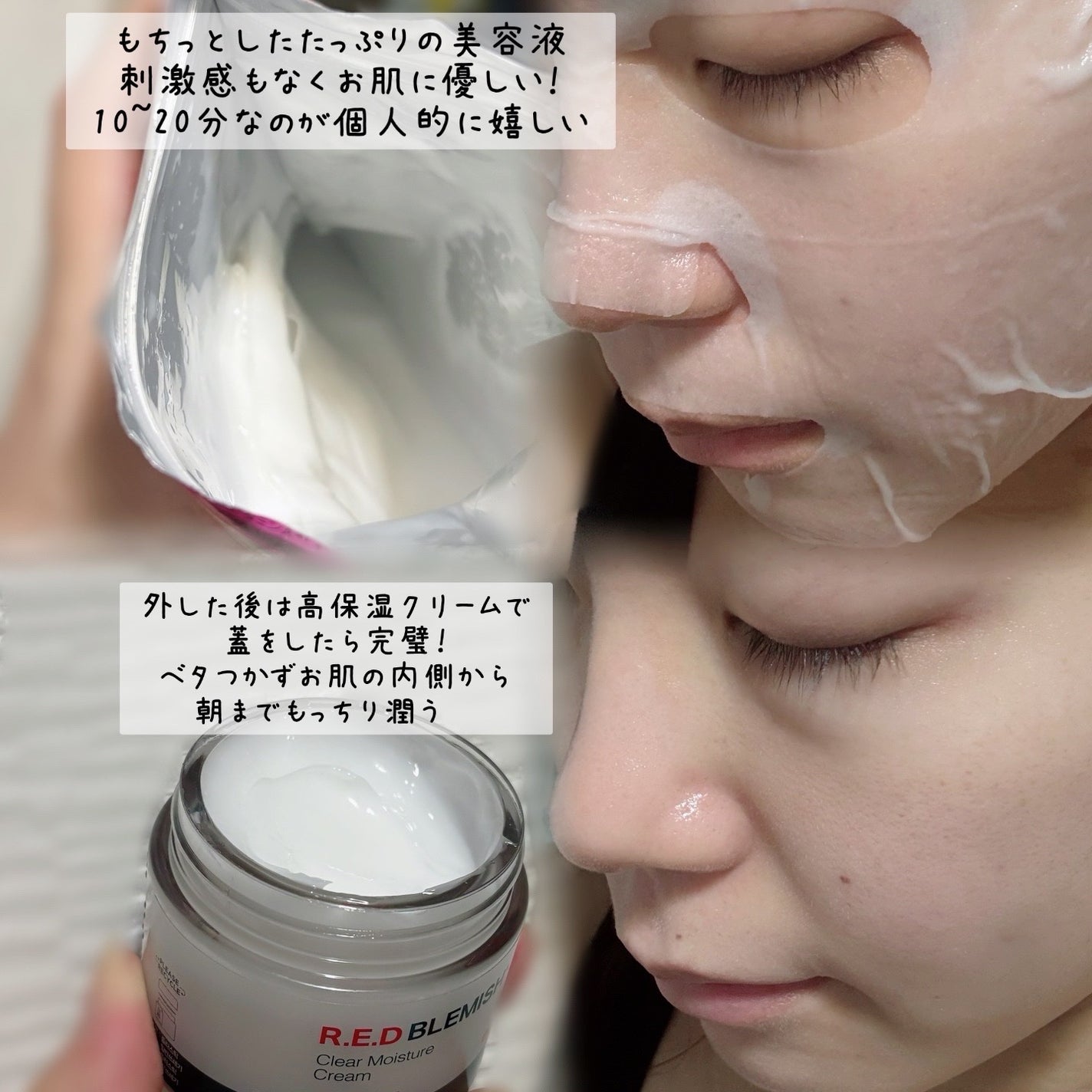 レッドブレミッシュ クリアモイスチャークリーム/Dr.G/フェイスクリームを使ったクチコミ(2枚目)