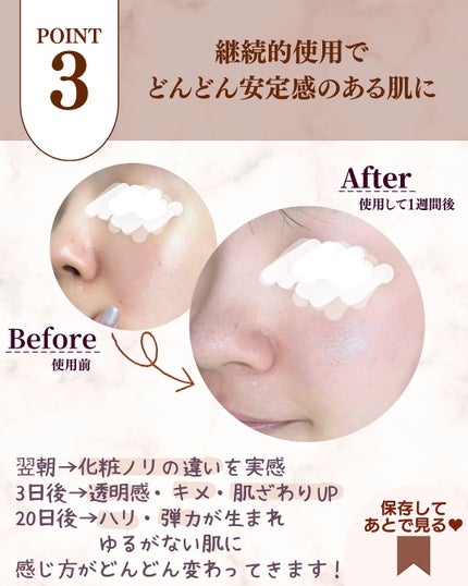 アドバンス ナイト リペア SMR コンプレックス/ESTEE LAUDER/美容液を使ったクチコミ(6枚目)