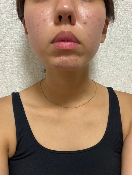 を使ったクチコミ(1枚目)