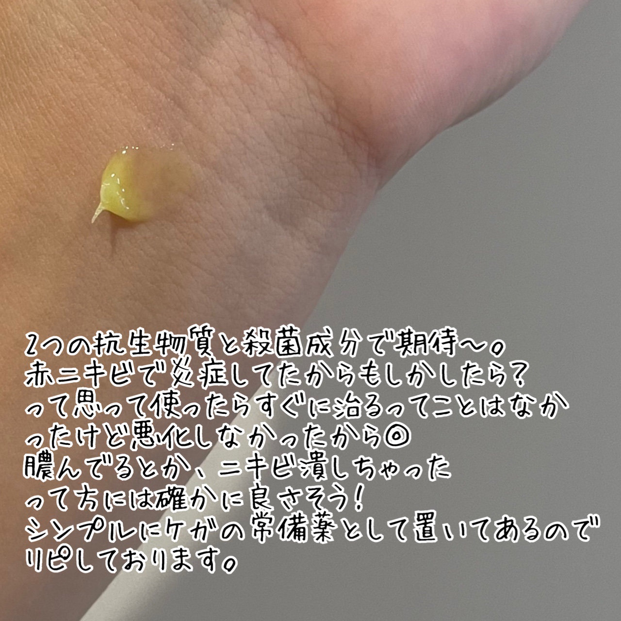 テラマイシン 軟膏(医薬品)/ジョンソン・エンド・ジョンソン/その他を使ったクチコミ（3枚目）