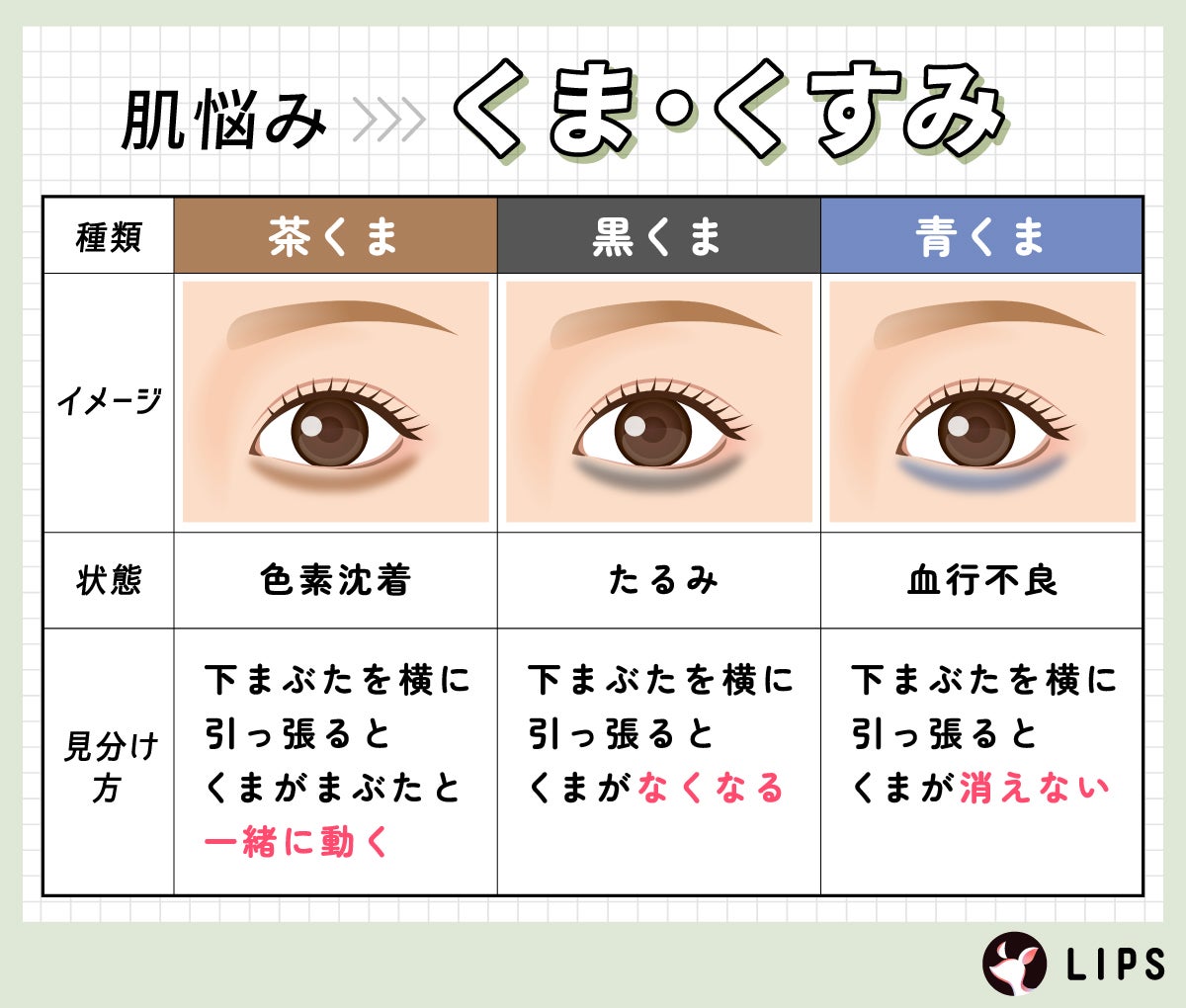 肌悩みがくま・くすみなら種類に合わせたケアをしよう! 茶くまは色素沈着している状態で、下まぶたを横に引っ張るとくまがまぶたと一緒に動く。黒くまはたるみが生じており、下まぶたを横に引っ張るとくまがなくなる。青くまは血行不良の状態で、下まぶたを横に引っ張るとくまが消えない。