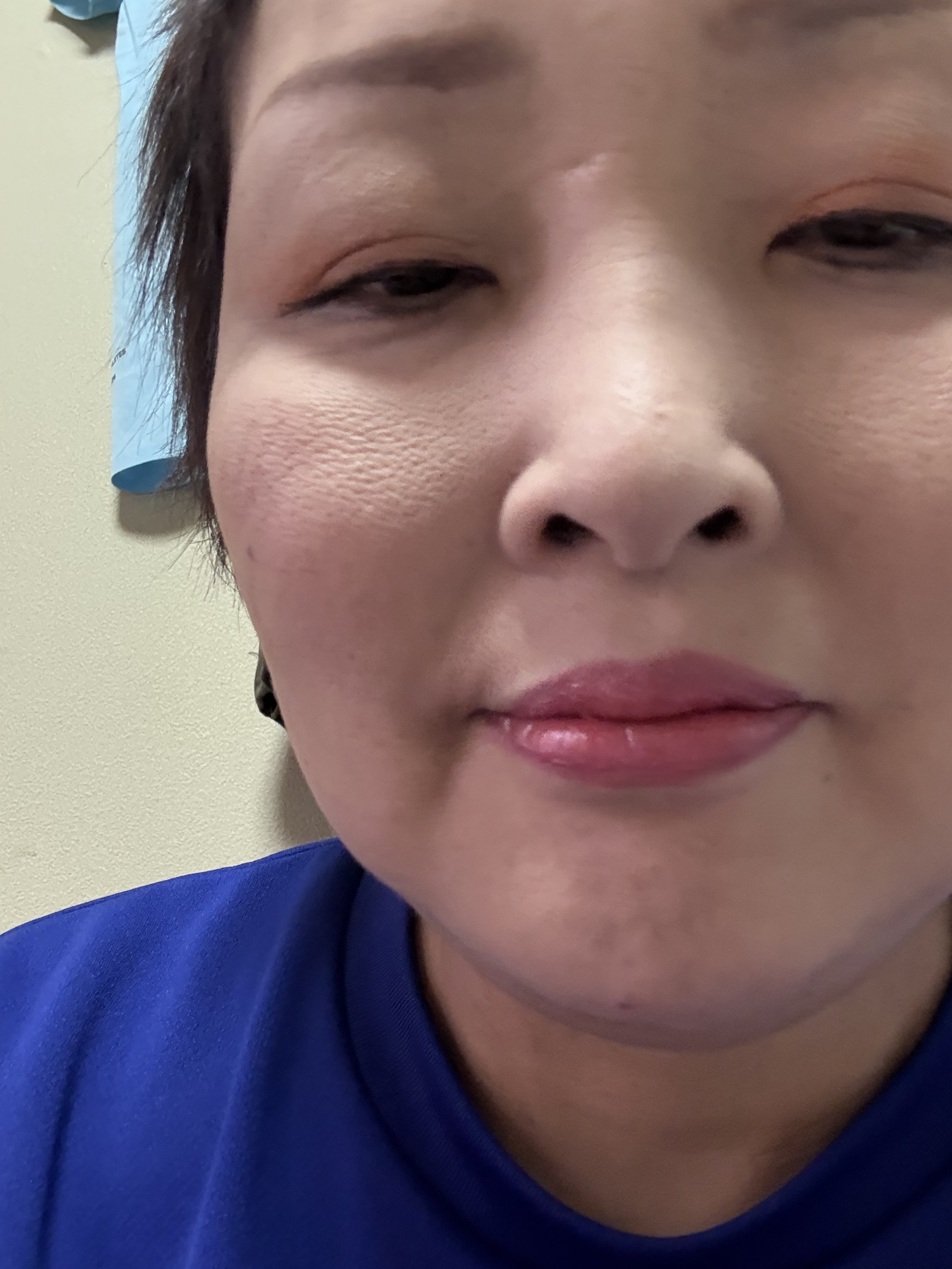 ドラマティックエッセンスルージュ RD401/マキアージュ/口紅を使ったクチコミ（2枚目）