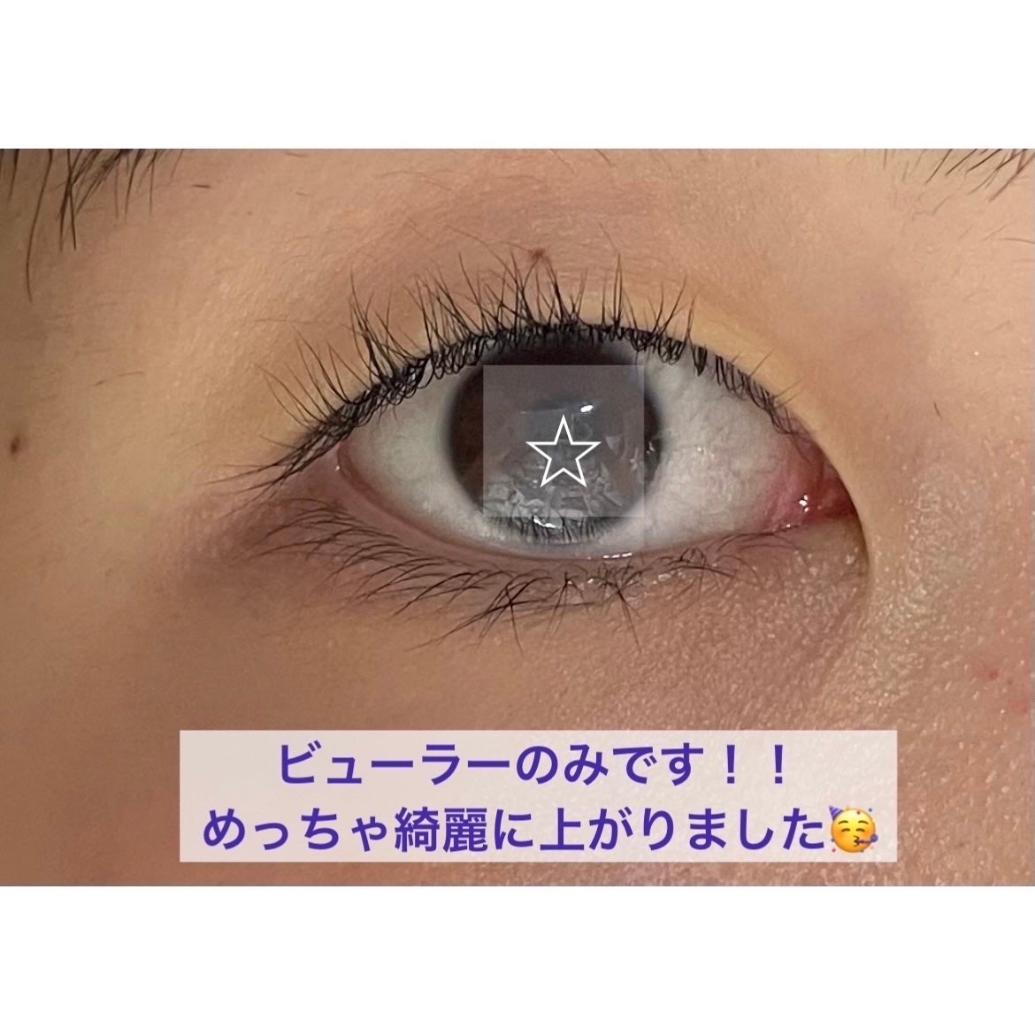 ひとえ・奥ぶたえ用カーラー/アイプチ®/ビューラーを使ったクチコミ(2枚目)