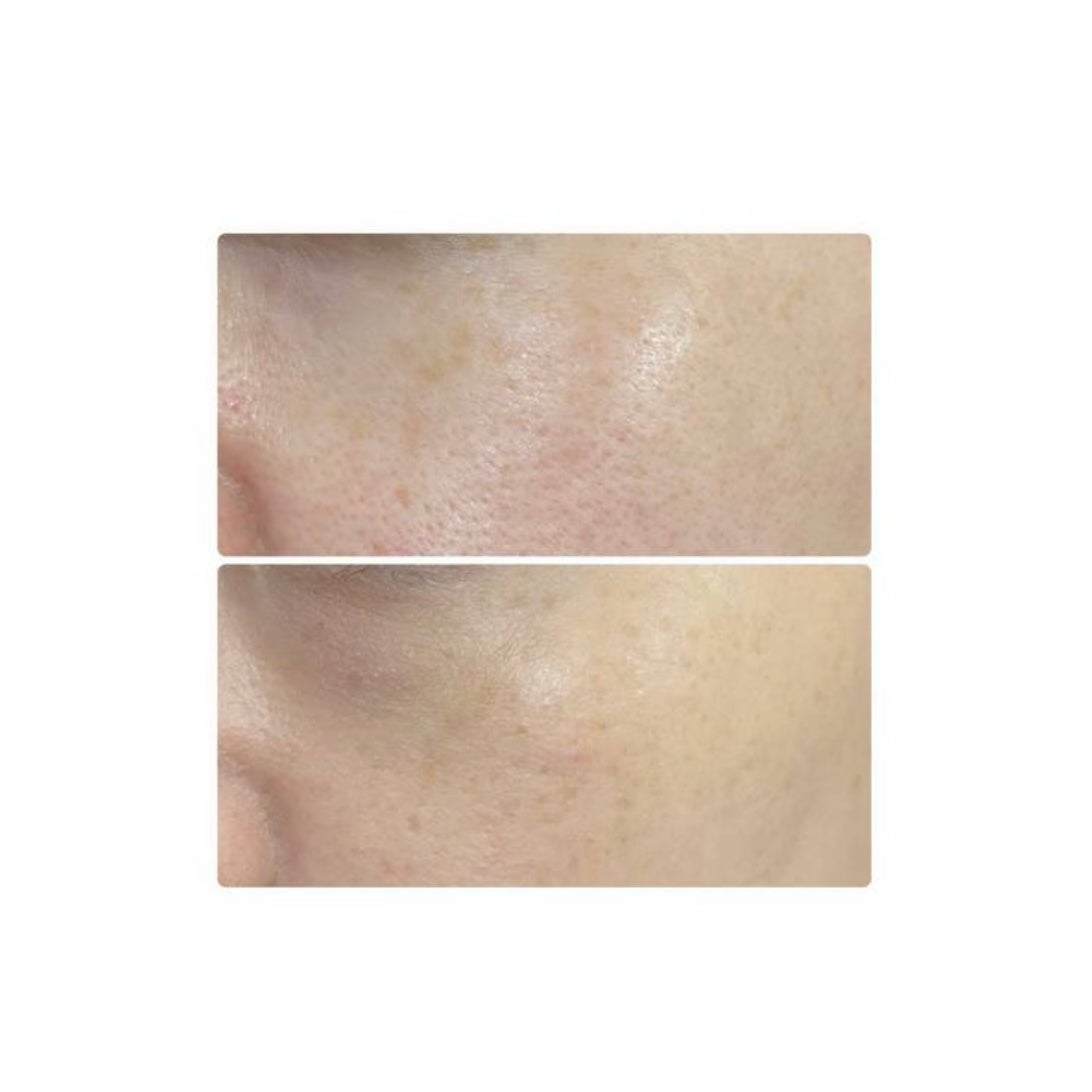 ソフトマットプレストパウダー/FUNNY ELVES方里/プレストパウダーを使ったクチコミ(3枚目)