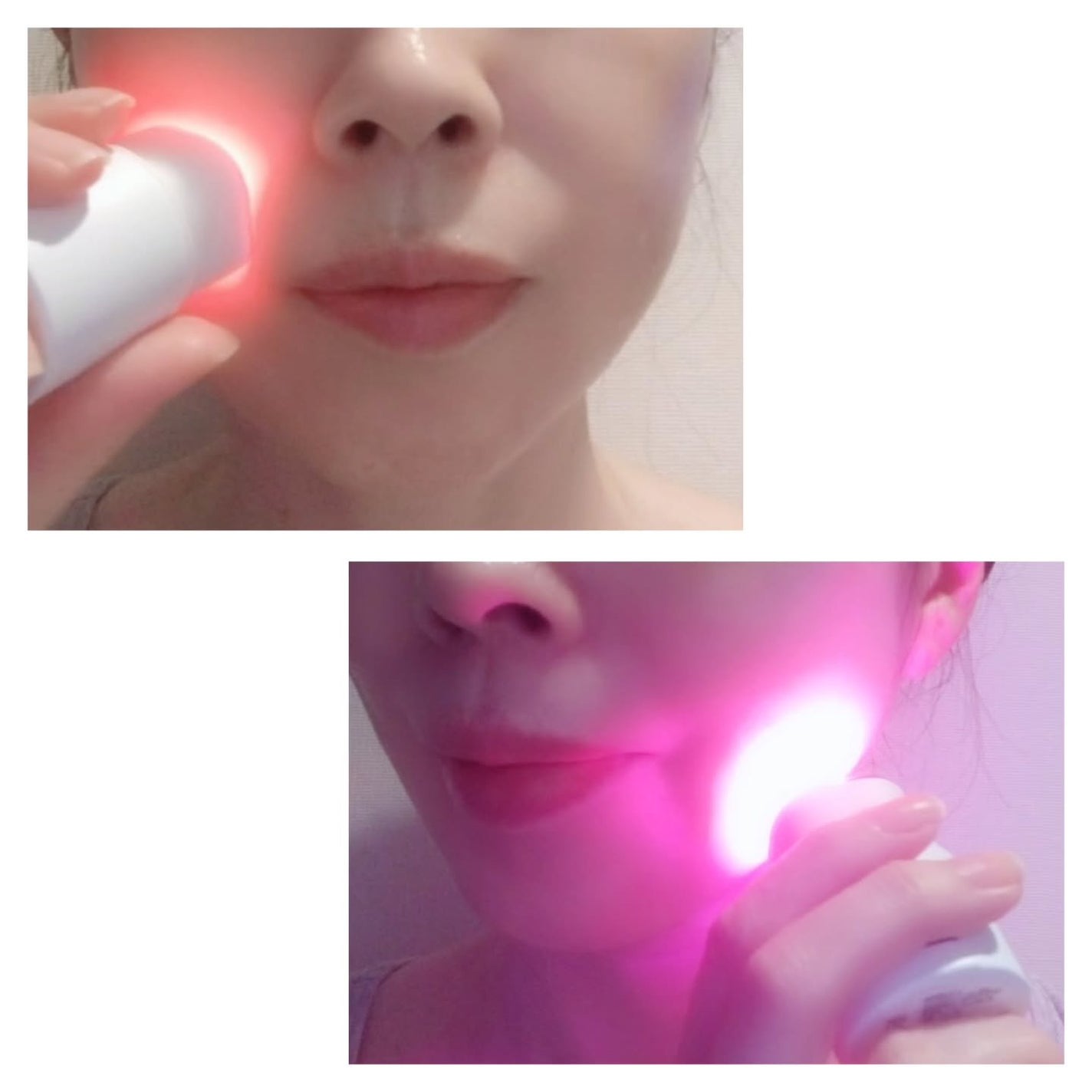 トラブルカーミングクイックブースターショット/CNP Laboratory/美顔器・マッサージを使ったクチコミ(3枚目)