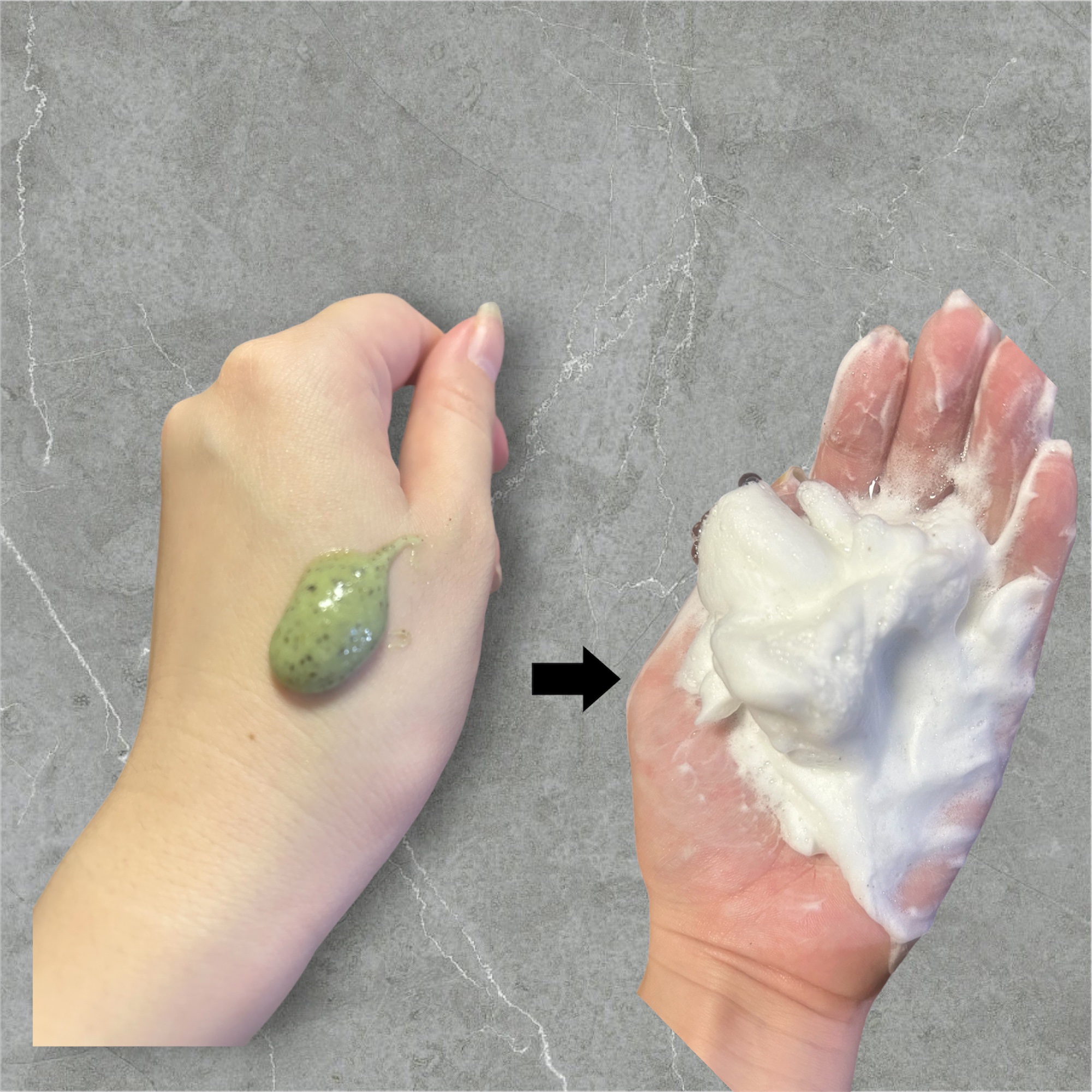 リードルショット700/VT/美容液を使ったクチコミ（3枚目）