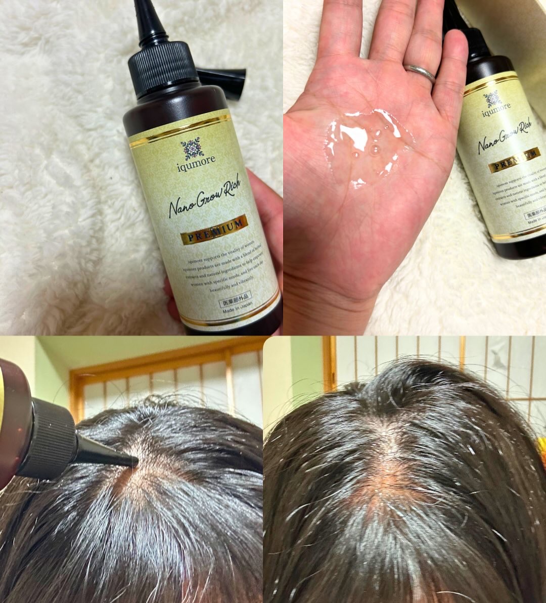 イクモアナノグロウリッチプレミアム/iqumore/頭皮ローションを使ったクチコミ（2枚目）
