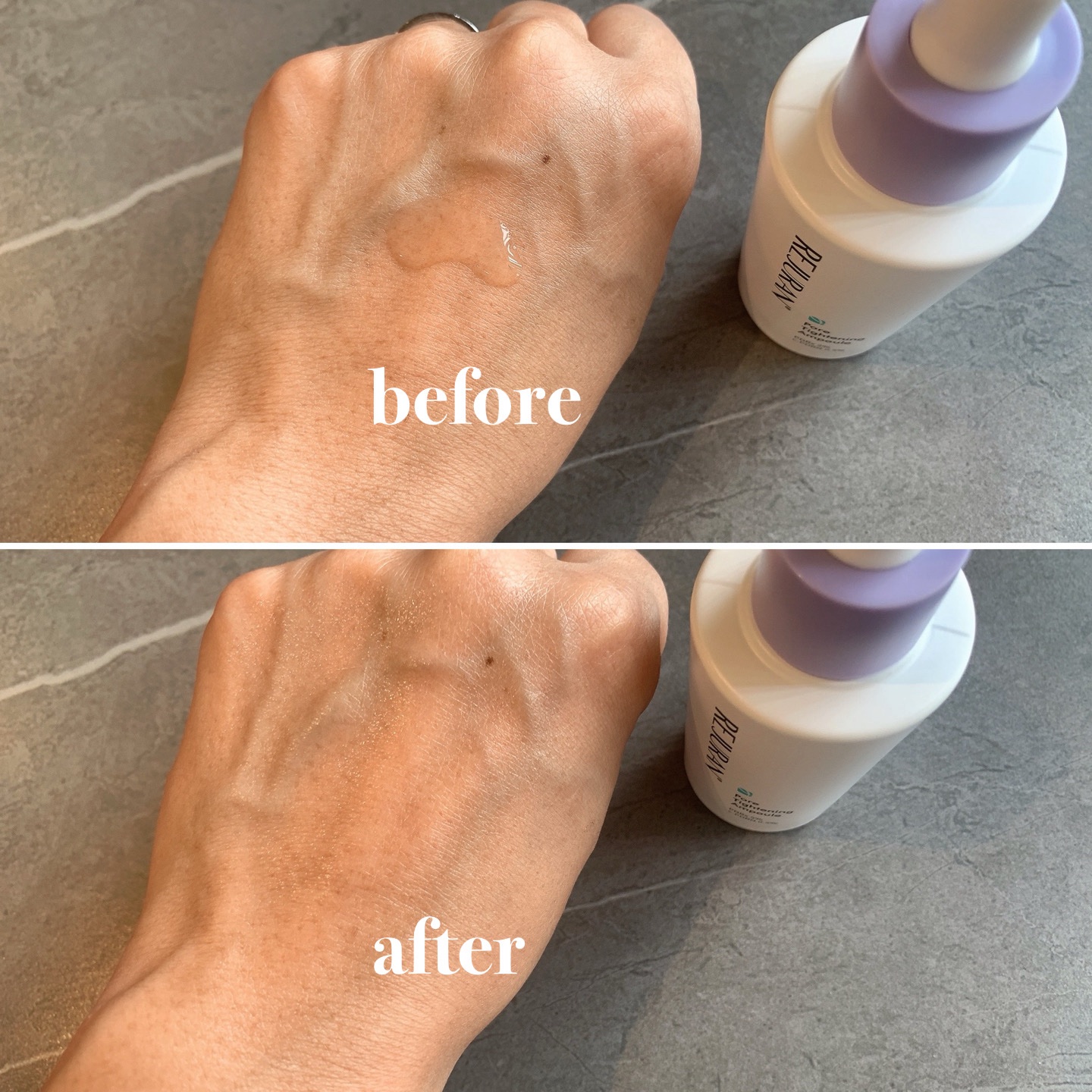 REJURAN ダーマヒーラー ポアタイトニングアンプル 30ml/REJURAN COSMETICS/美容液を使ったクチコミ（3枚目）