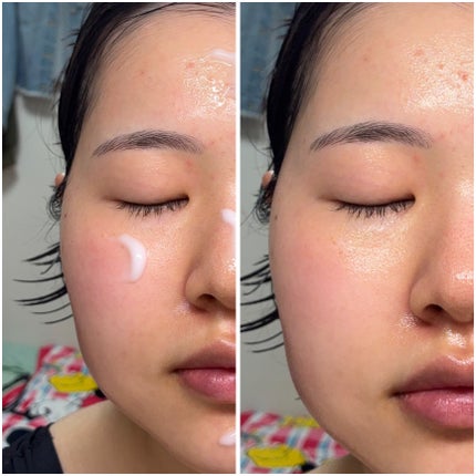 レッドブレミッシュ クリアスージングクリーム/Dr.G/フェイスクリームを使ったクチコミ(4枚目)