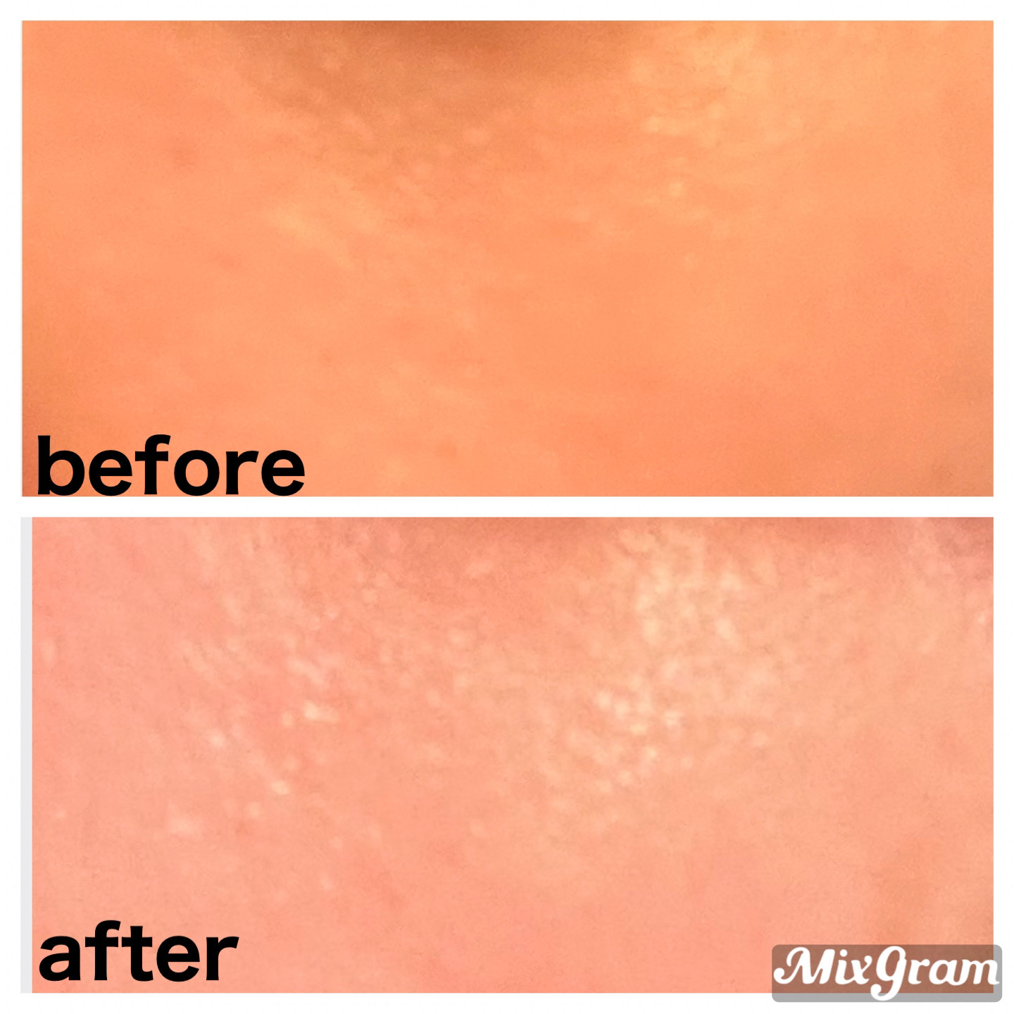 PDRN ヒアルロン酸 ミントマイクロバブルセラム/VT/美容液を使ったクチコミ（3枚目）