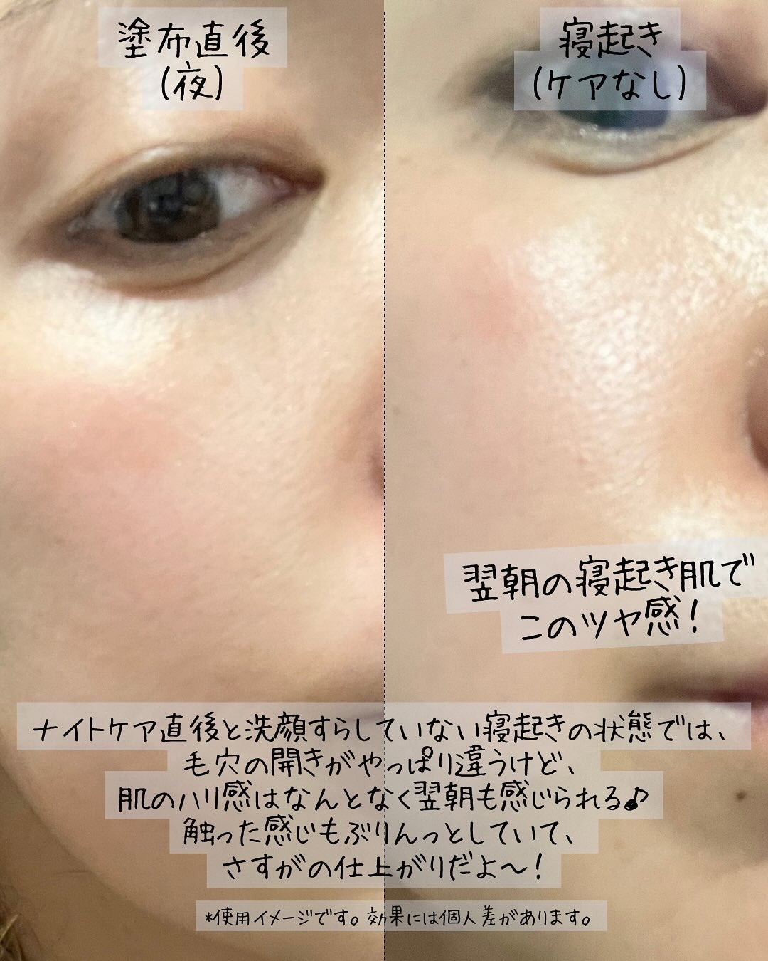 リペアジェル/リソウコーポレーション/美容液を使ったクチコミ(5枚目)