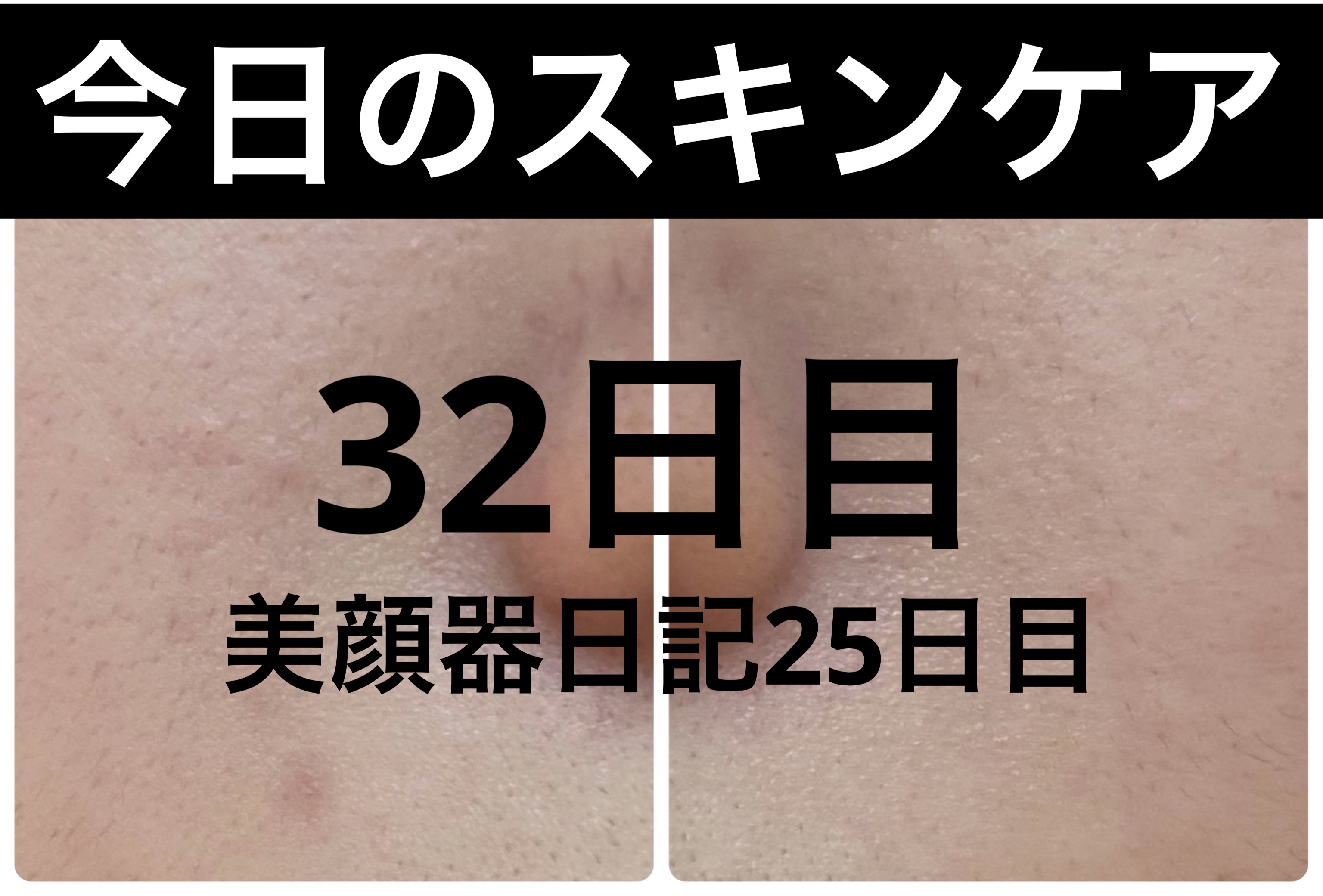 薬用雪肌精 ブライトニング クレンジング オイル[医薬部外品] 150mL/雪肌精/オイルクレンジングを使ったクチコミ（1枚目）