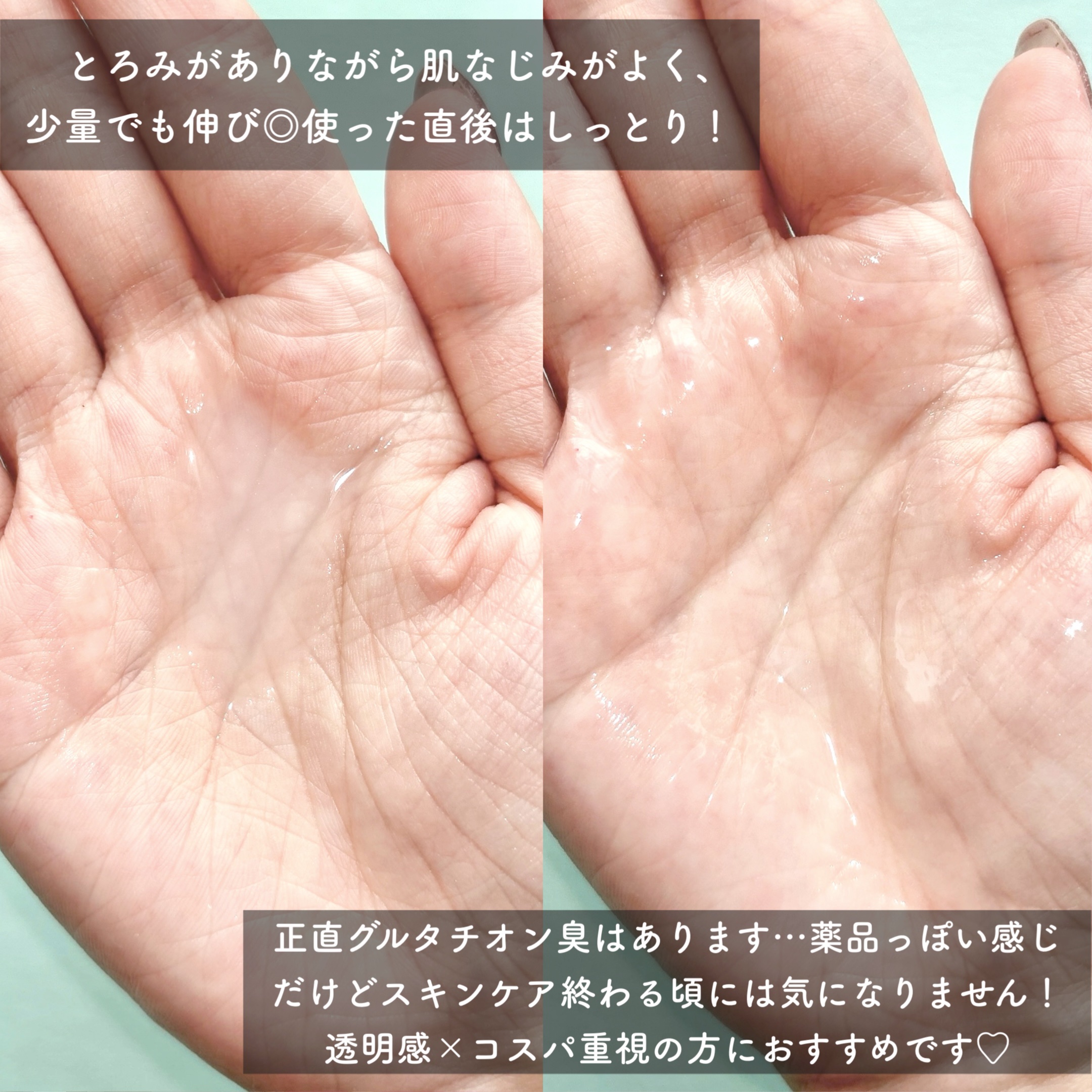 グルタチオンアンプルトナー/SKIN&LAB/化粧水を使ったクチコミ（3枚目）