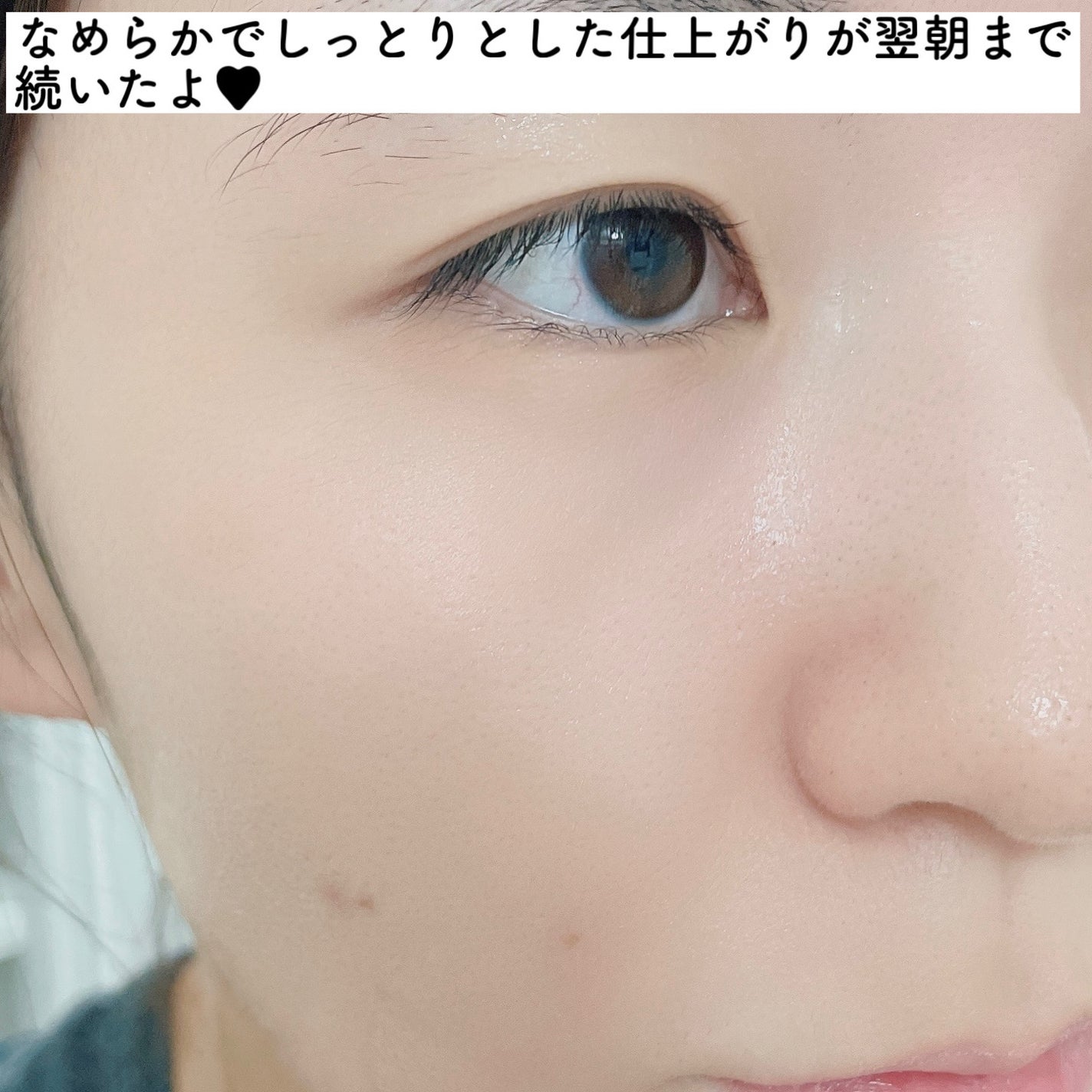 REJURAN ターンオーバーマスク(5枚入り)/REJURAN COSMETICS/シートマスク・パックを使ったクチコミ(6枚目)