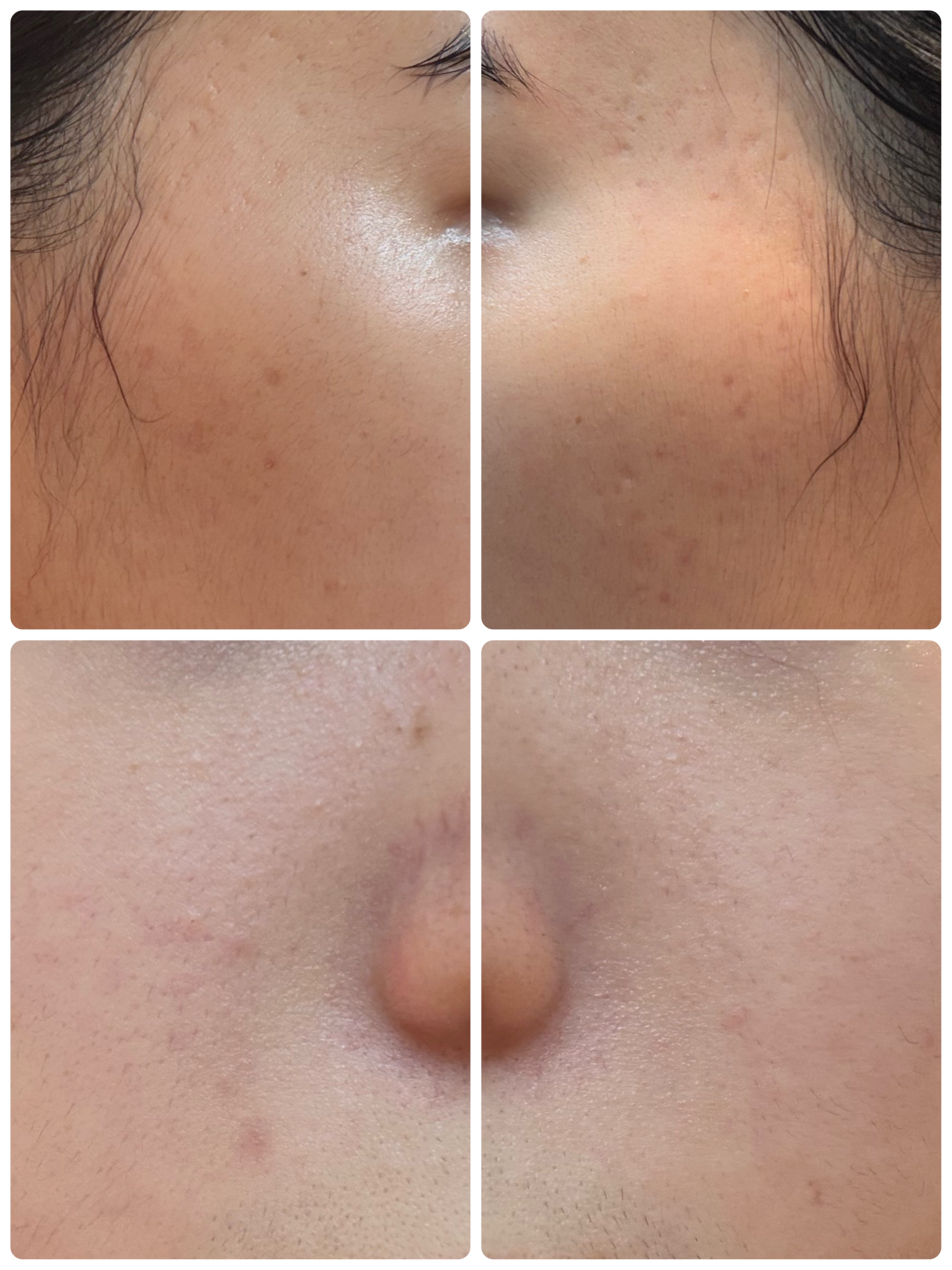 薬用雪肌精 ブライトニング クレンジング オイル[医薬部外品] 150mL/雪肌精/オイルクレンジングを使ったクチコミ（2枚目）