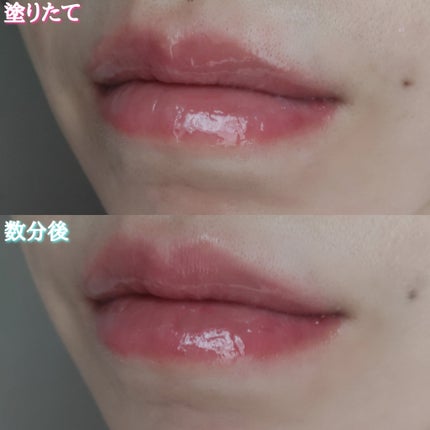 デイニードルリップ/CHOOSY/リップ美容液を使ったクチコミ(5枚目)