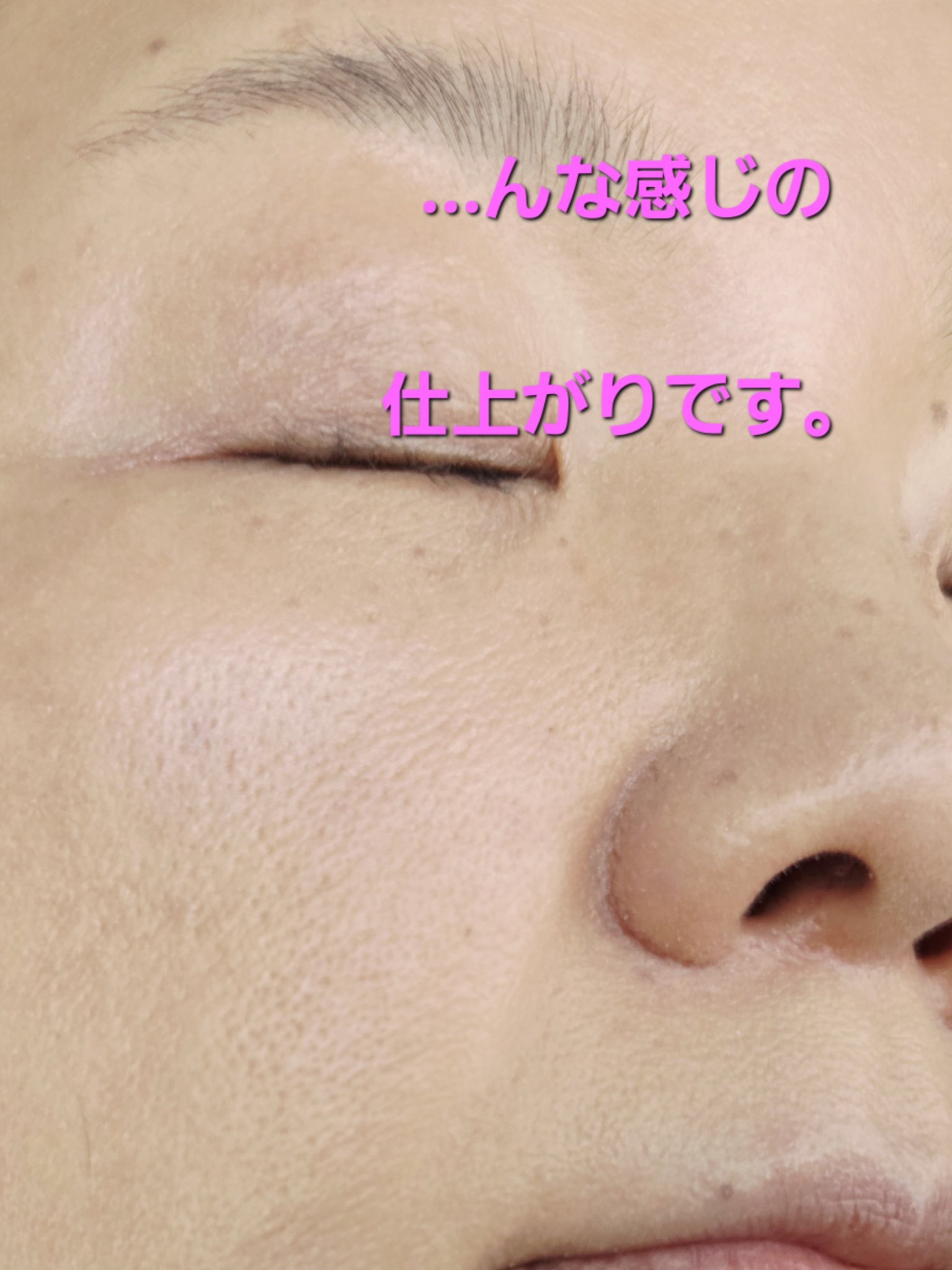 Aluce luce Plus クッションファンデーション ケース/Aluce luce/クッションファンデーションを使ったクチコミ（3枚目）