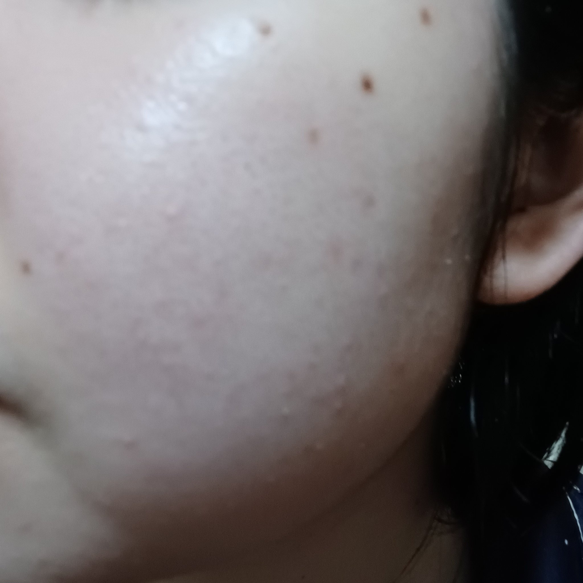 薬用パウダー化粧水/メンソレータム アクネス/化粧水を使ったクチコミ（2枚目）